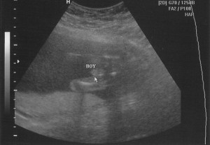 sonogram20090126